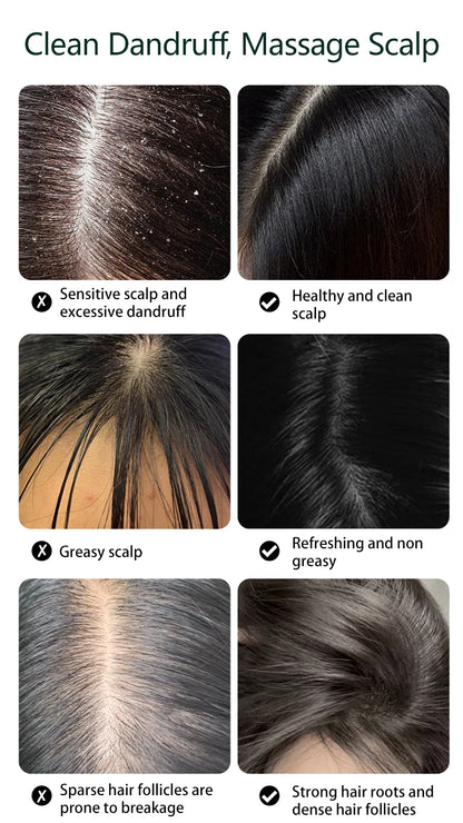 Electric Head Scratcher Scalp Massager with 84 Kneading Nodes Handheld Hair Growth Stimulation Device Gift for Mom Dad Women Men
