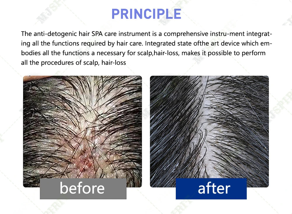 Massage 5 in 1 Electric Scalp Therapy Machine Bubble Hair Scalp Massage Hair Regeneration Device Beauty Salon/Spa