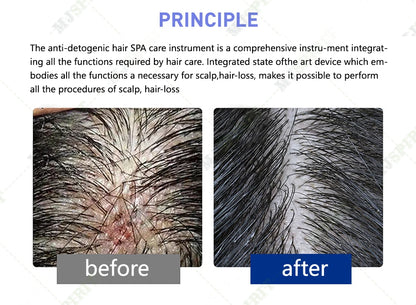 Massage 5 in 1 Electric Scalp Therapy Machine Bubble Hair Scalp Massage Hair Regeneration Device Beauty Salon/Spa